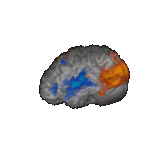 a gif of a rotating brain. it is a 3D MRI scan. several areas are lit up in orange and blue